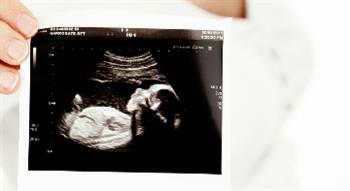 Woman holding baby scan picture
